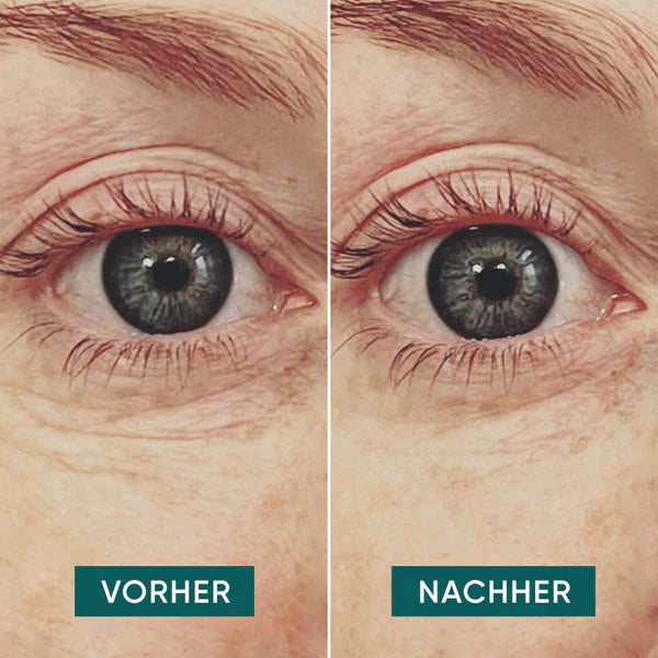 APRICOT - Augen Pads mit Hyaluron, 30 Stk.
