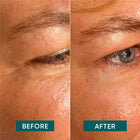 APRICOT Augen-Schläfen Pads mit Aloe Vera, 2 Stück