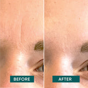 APRICOT Multipack Gesicht- und Mund Patches mit Hyaluron für glatter wirkende Haut
