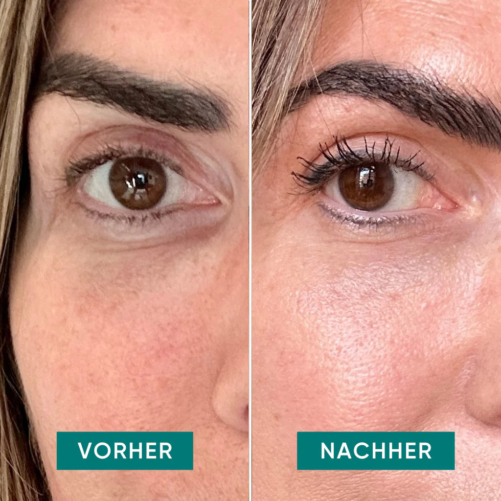 APRICOT Augen- und Schläfen Pads mit Hyaluron für die Pflege der empfindlichen Augenpartie